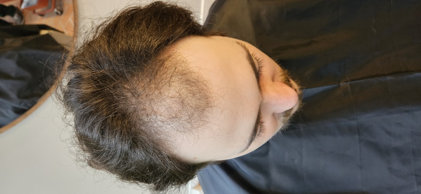 Henrique antes do transplante